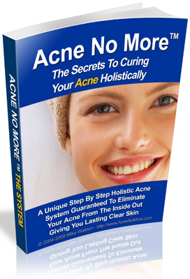 How to cure acne